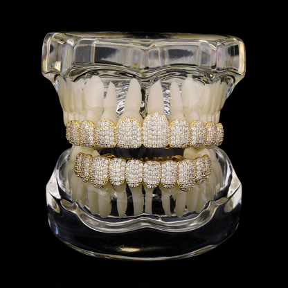Last Day 49% OFF🔥 DIAMOND GRILLZ - Full diamond crusted grillz for maximum shine